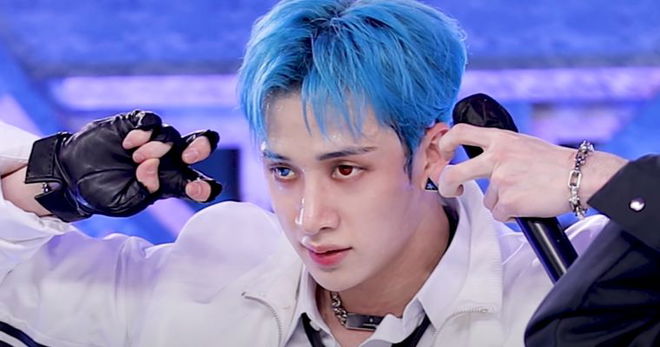 stray-kids-bang-chan-undergoes-minor-surgery-idol-confirms-hes-recovering