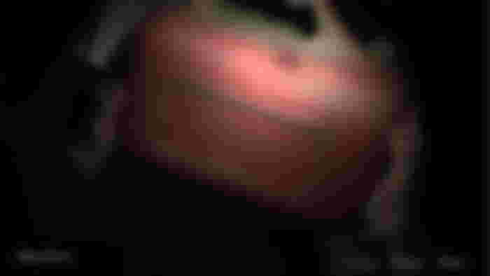 Silent Hill 2 Remake screenshot