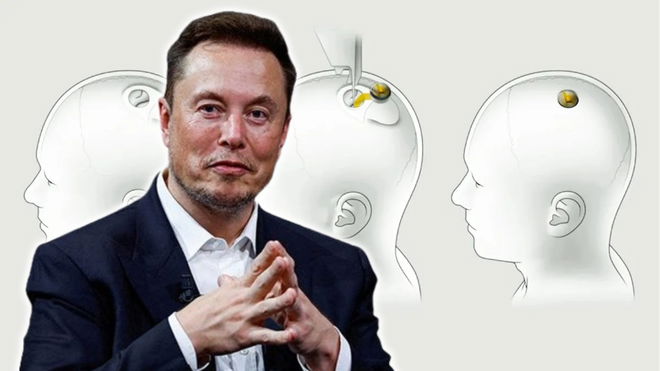 elon musk neuralink human brain chip